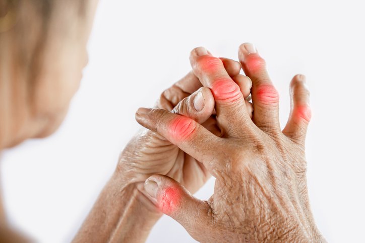 Seis sintomas precoces de artrite reumatoide