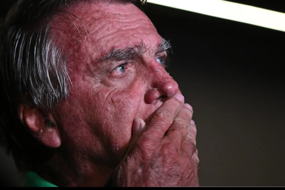 Bolsonaro é internado às pressas em Brasília com quadro agravado de saúde